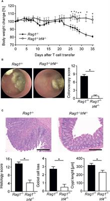 Th17 Cell-Mediated Colitis Is Positively Regulated by Interferon Regulatory Factor 4 in a T Cell-Extrinsic Manner